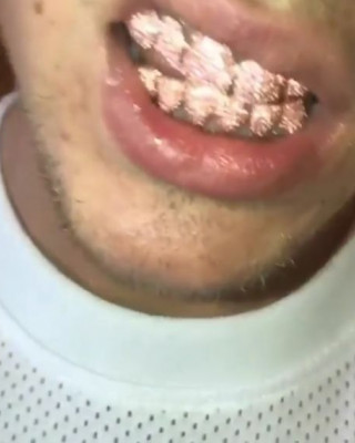 Фото 57531 к новости Джастин Бибер сделал себе золотые зубы 